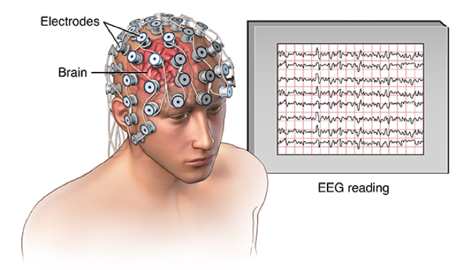 EEG